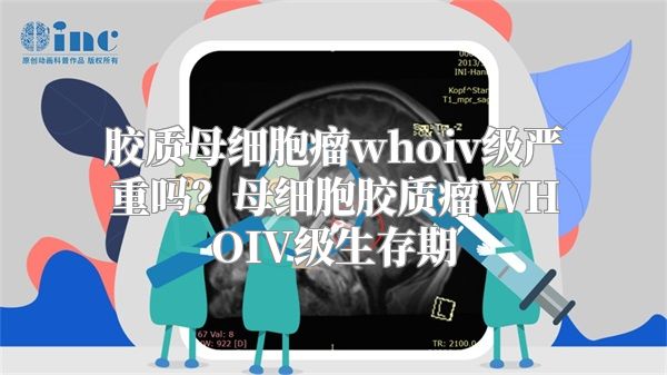 胶质母细胞瘤whoiv级严重吗？母细胞胶质瘤WHOIV级生存期