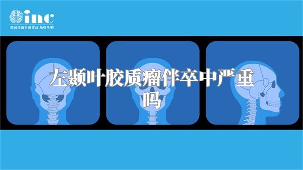 左颞叶胶质瘤伴卒中严重吗