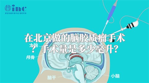 在北京做的脑胶质瘤手术？手术量是多少毫升？