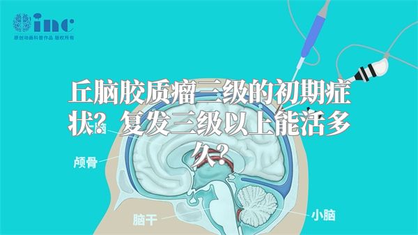 丘脑胶质瘤三级的初期症状？复发三级以上能活多久？