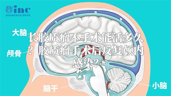 长胶质瘤不手术能活多久？胶质瘤手术后反复颅内感染？