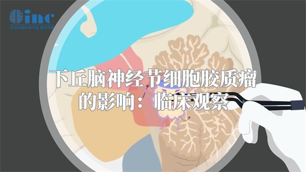 下丘脑神经节细胞胶质瘤的影响：临床观察