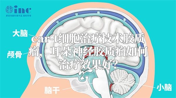 car-t细胞治疗技术胶质瘤，耳朵神经胶质瘤如何治疗效果好？