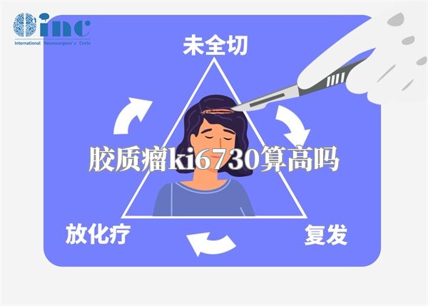 胶质瘤ki6730算高吗