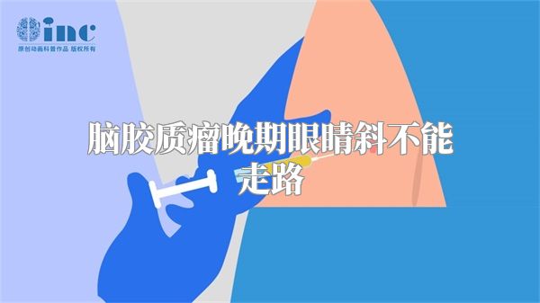 脑胶质瘤晚期眼睛斜不能走路