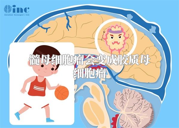 髓母细胞瘤会变成胶质母细胞瘤