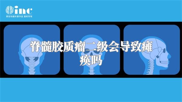 脊髓胶质瘤二级会导致瘫痪吗