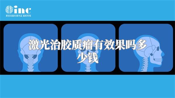 激光治胶质瘤有效果吗多少钱
