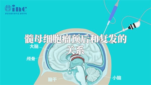 髓母细胞瘤预后和复发的关系