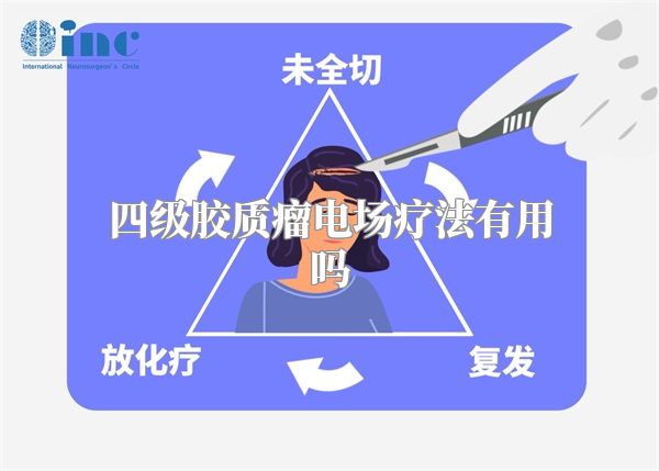四级胶质瘤电场疗法有用吗