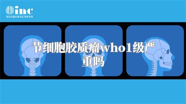节细胞胶质瘤who1级严重吗