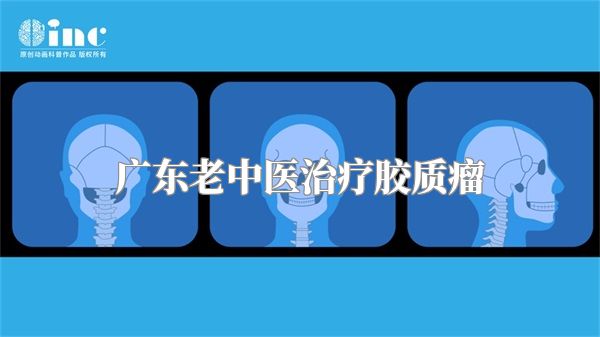 广东老中医治疗胶质瘤