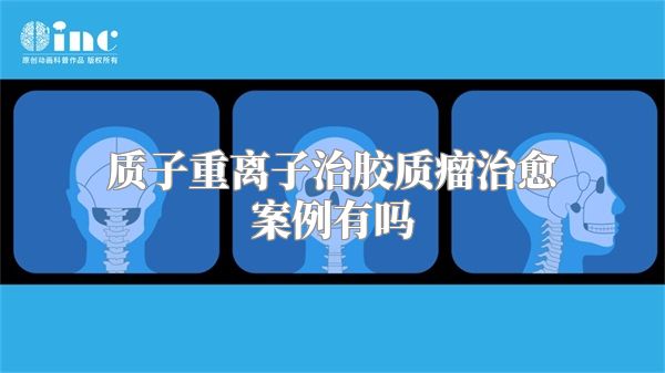 质子重离子治胶质瘤治愈案例有吗