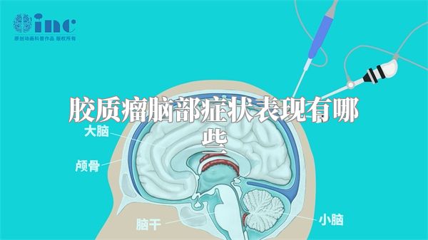 胶质瘤脑部症状表现有哪些
