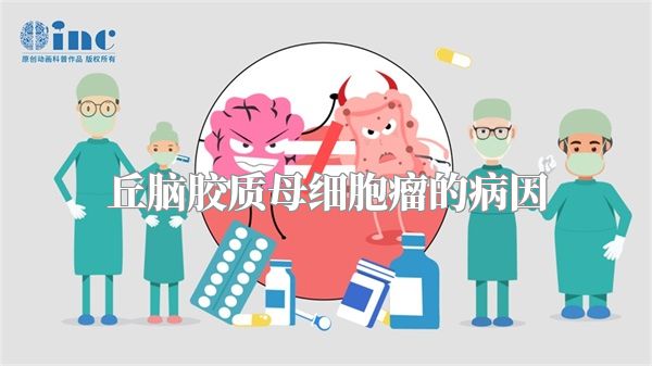 丘脑胶质母细胞瘤的病因