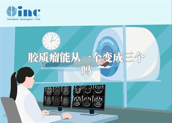 胶质瘤能从一个变成三个吗