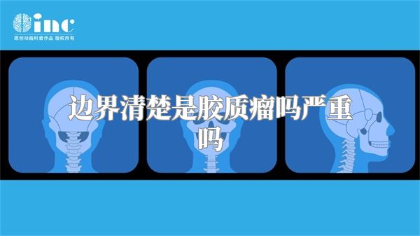 边界清楚是胶质瘤吗严重吗