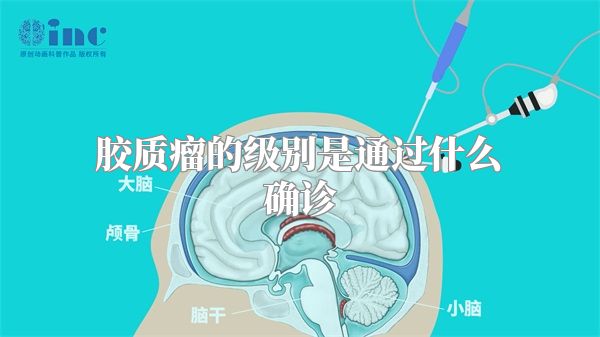 胶质瘤的级别是通过什么确诊