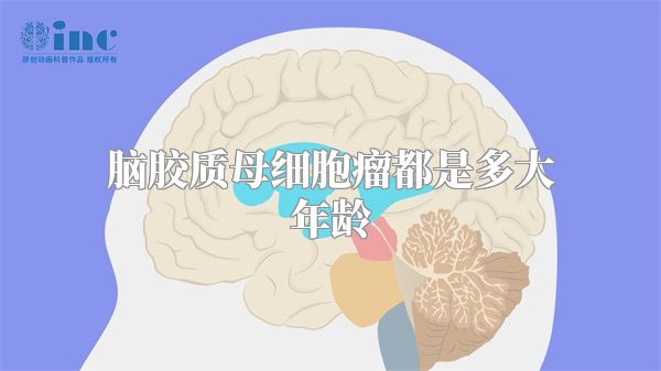 脑胶质母细胞瘤都是多大年龄