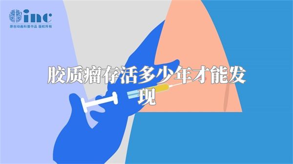 胶质瘤存活多少年才能发现