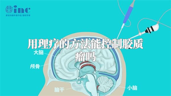 用理疗的方法能控制胶质瘤吗