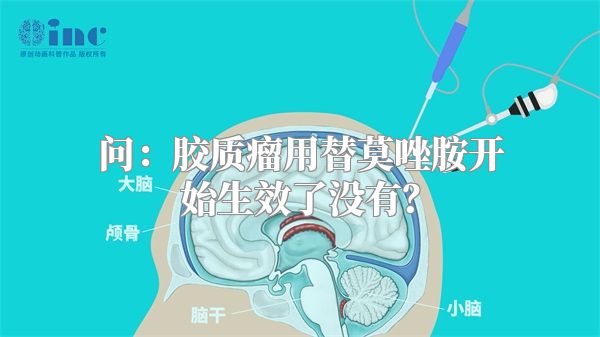 问：胶质瘤用替莫唑胺开始生效了没有？