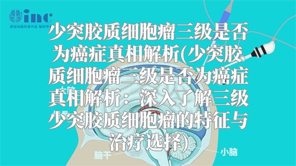 少突胶质细胞瘤三级是否为癌症真相解析(少突胶质细胞瘤三级是否为癌症真相解析：深入了解三级少突胶质细胞瘤的特征与治疗选择)
