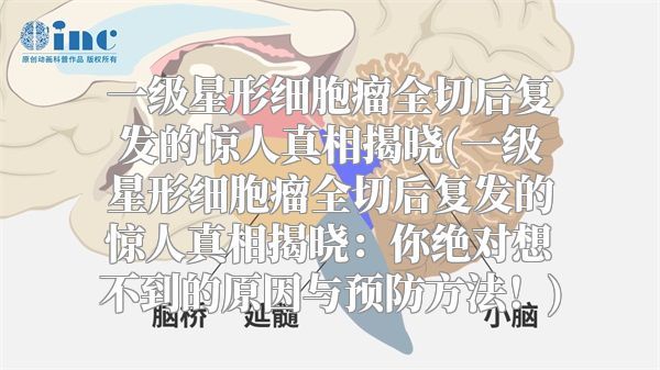 一级星形细胞瘤全切后复发的惊人真相揭晓(一级星形细胞瘤全切后复发的惊人真相揭晓：你绝对想不到的原因与预防方法！)