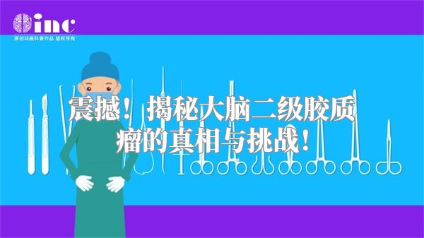震撼！揭秘大脑二级胶质瘤的真相与挑战！