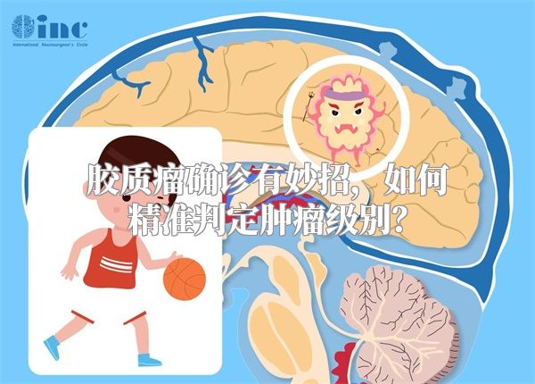 胶质瘤确诊有妙招，如何精准判定肿瘤级别？