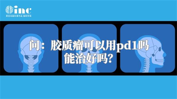 问：胶质瘤可以用pd1吗能治好吗？