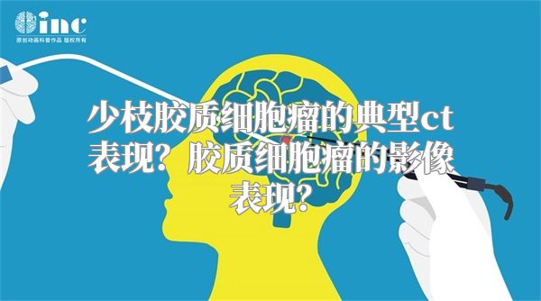 少枝胶质细胞瘤的典型ct表现？胶质细胞瘤的影像表现？