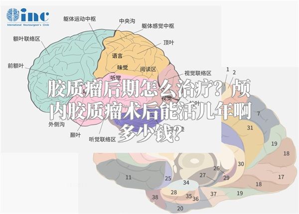 胶质瘤后期怎么治疗？颅内胶质瘤术后能活几年啊多少钱？