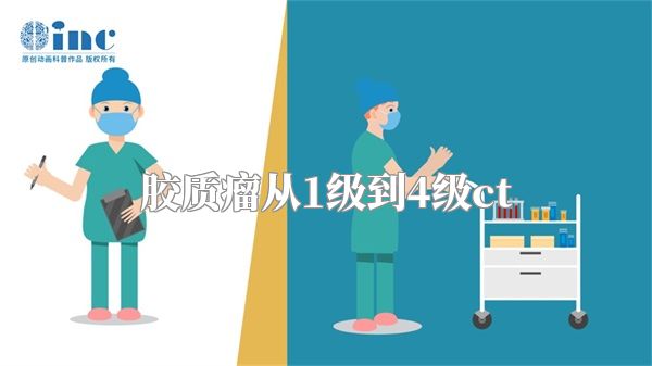 胶质瘤从1级到4级ct
