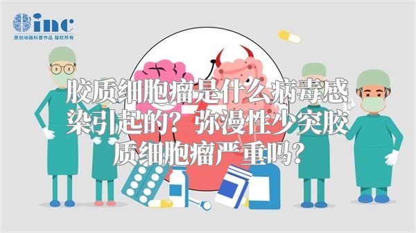 胶质细胞瘤是什么病毒感染引起的？弥漫性少突胶质细胞瘤严重吗？