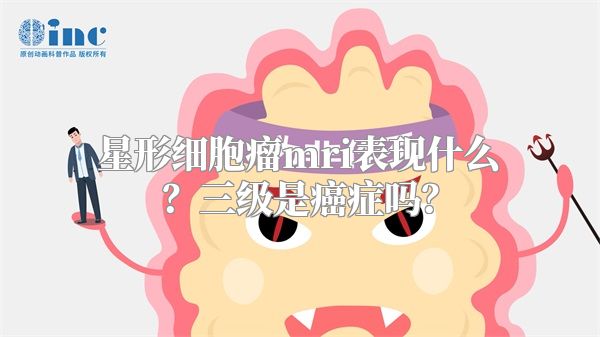 星形细胞瘤mri表现什么？三级是癌症吗？