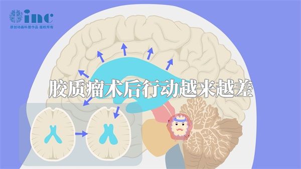 胶质瘤术后行动越来越差
