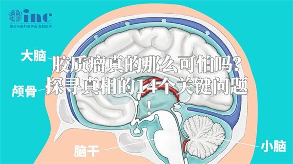 胶质瘤真的那么可怕吗？探寻真相的14个关键问题！