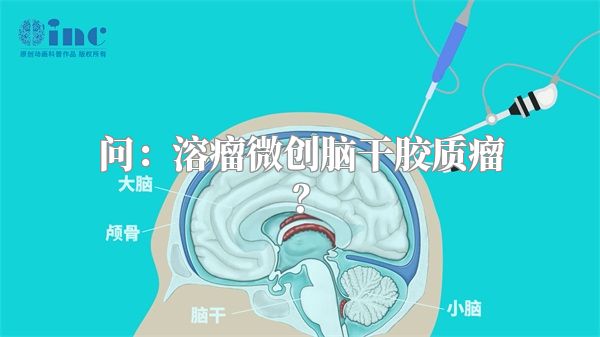 问：溶瘤微创脑干胶质瘤？