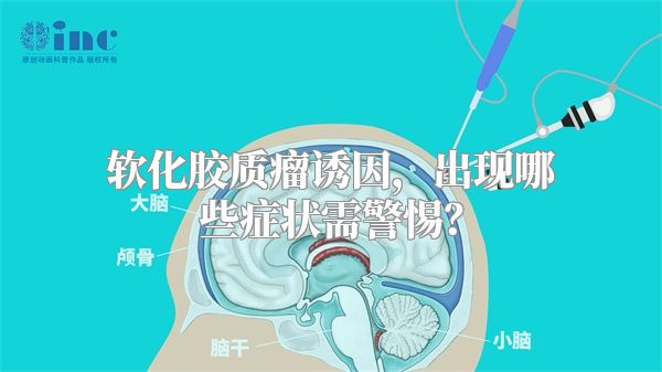 软化胶质瘤诱因，出现哪些症状需警惕？