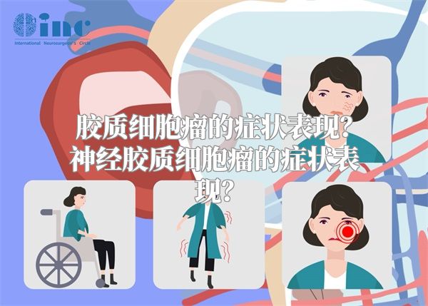 胶质细胞瘤的症状表现？神经胶质细胞瘤的症状表现？