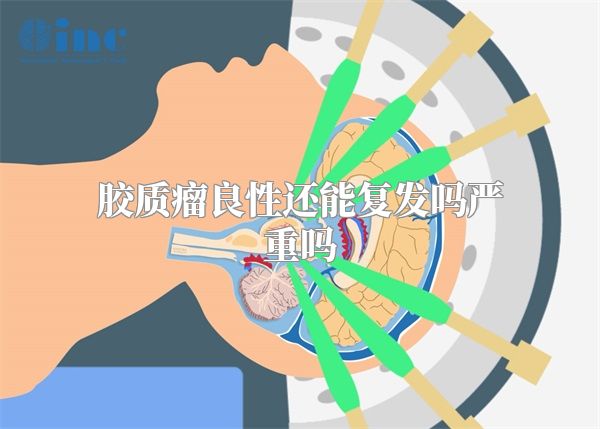 胶质瘤良性还能复发吗严重吗