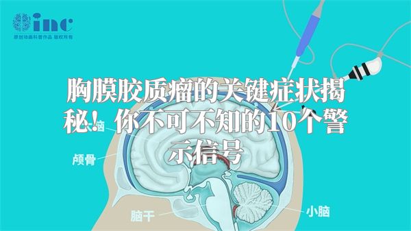 胸膜胶质瘤的关键症状揭秘！你不可不知的10个警示信号