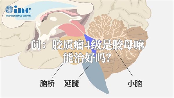 问：胶质瘤4级是胶母嘛能治好吗？