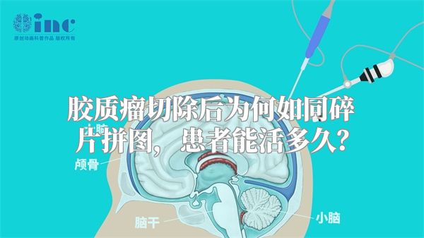 胶质瘤切除后为何如同碎片拼图，患者能活多久？