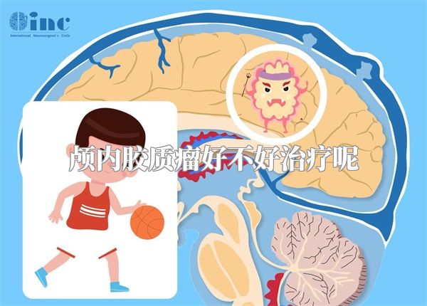 颅内胶质瘤好不好治疗呢