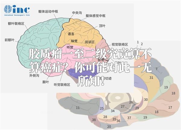 胶质瘤一至二级究竟算不算癌症？你可能对此一无所知！