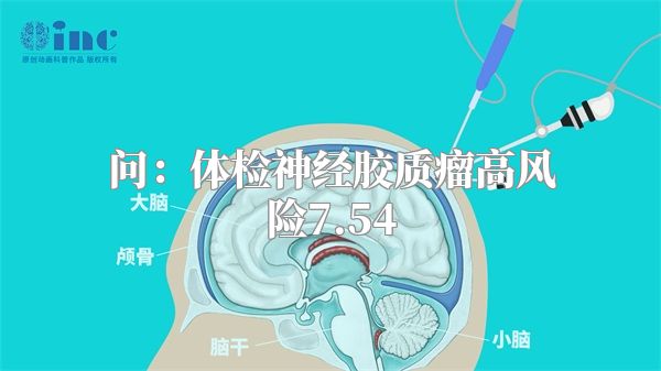 问：体检神经胶质瘤高风险7.54