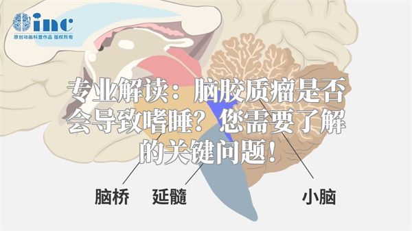 专业解读：脑胶质瘤是否会导致嗜睡？您需要了解的关键问题！