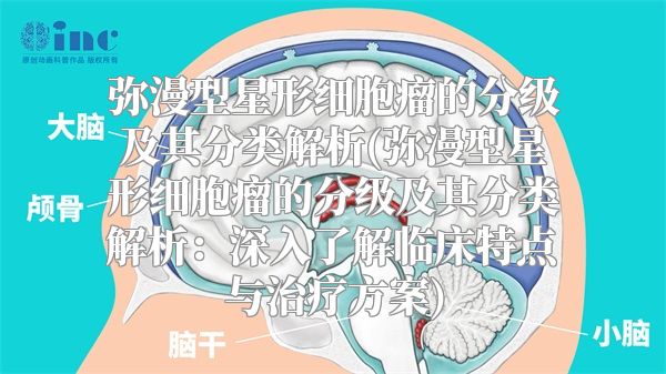 弥漫型星形细胞瘤的分级及其分类解析(弥漫型星形细胞瘤的分级及其分类解析：深入了解临床特点与治疗方案)